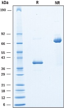Recombinant Human CD9-LEL Fc Chimera Protein SDS-PAGE