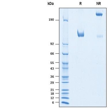 Recombinant Human CDCP1 Fc Chimera Protein SDS-PAGE