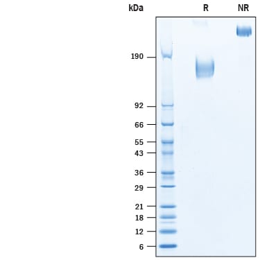 Recombinant Human CEACAM-5/CD66e Fc Chimera Protein SDS-PAGE
