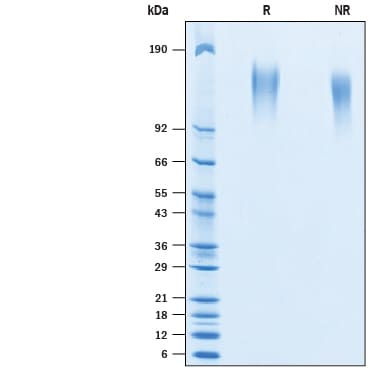 Recombinant Human CEACAM-5/CD66e His-tag Avi-tag Protein SDS-PAGE