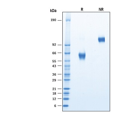 Recombinant Human CLEC17A Fc Chimera Protein SDS-PAGE