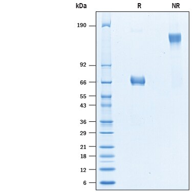 Recombinant Human CMG-2/ANTXR2 Fc Chimera Protein SDS-PAGE
