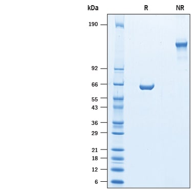 Recombinant Mouse CMG-2/ANTXR2 Fc Chimera Protein SDS-PAGE