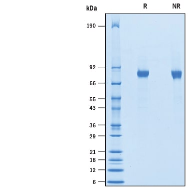 Recombinant Human CNTFR/CNTF Complex Protein SDS-PAGE