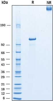 Recombinant Human COMP His-tag Protein SDS-PAGE