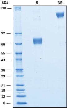 Recombinant Human CRACC/SLAMF7 Fc Chimera Protein SDS-PAGE