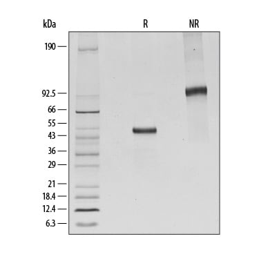 Recombinant Human CTLA-4 Fc Chimera His-tag Protein SDS-PAGE