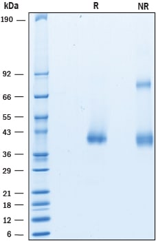 Recombinant Mouse CTRP9/C1qTNF9 His-tag Protein SDS-PAGE