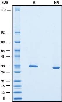 Recombinant Mouse Chondroadherin His-tag Protein SDS-PAGE
