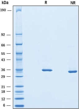 Recombinant Human Chondroadherin His-tag Protein SDS-PAGE