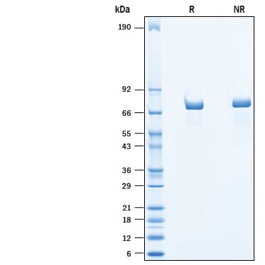 Recombinant Human Chromogranin A His-tag Protein SDS-PAGE