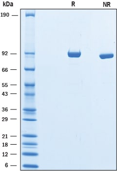 Recombinant Mouse Complement Component C3d Protein SDS-PAGE