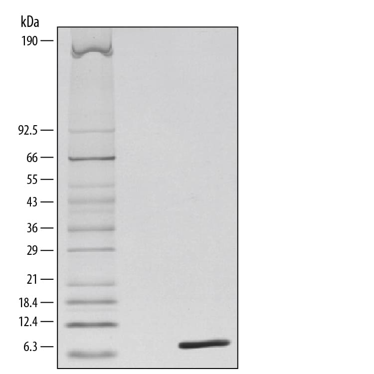 Recombinant Mouse Complement Component C5a Protein SDS-PAGE