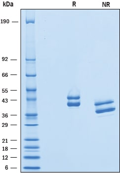 Recombinant Human Complement Factor H-related 1 His-tag SDS-PAGE