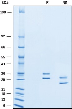Recombinant Human Complement Factor H-related 2 His-tag SDS-PAGE