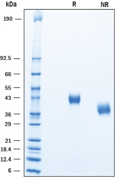 Recombinant Human Complement Factor H-related 4/CFHR4 SDS-PAGE