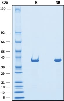 Recombinant Human Dihydroorotate Dehydrogenase Protein SDS-PAGE