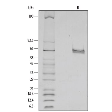 Recombinant Human DLL4 His-tag Protein SDS-PAGE