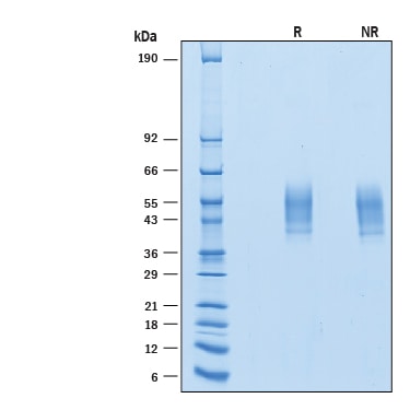 Recombinant Human DNAM-1/CD226 His-tag Avi-tag Protein SDS-PAGE