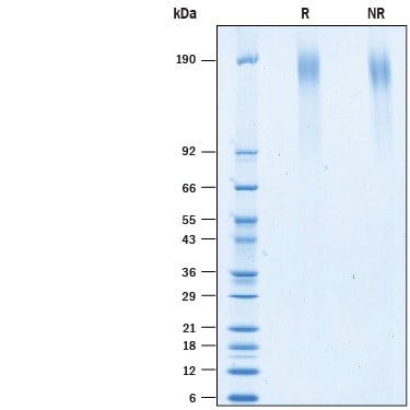 Recombinant Mouse EGFLAM Flag-tag Protein SDS-PAGE