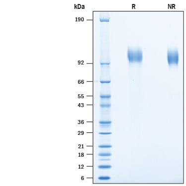 Recombinant Cynomolgus Monkey EGFR His-tag Protein SDS-PAGE