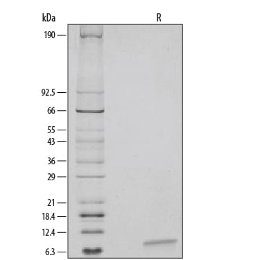 Recombinant Human EGF Protein SDS-PAGE