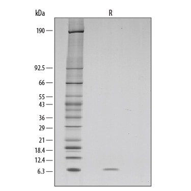 Recombinant Human EGF GMP Protein SDS-PAGE