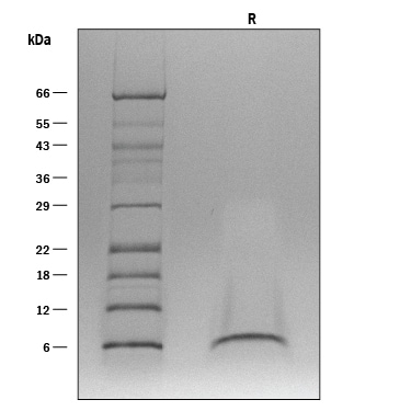 ProDots Recombinant Human EGF Protein SDS-PAGE