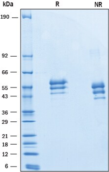 Recombinant Mouse EMMPRIN/CD147 His-tag Protein SDS-PAGE
