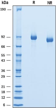 Recombinant Mouse Endorepellin His-tag Protein SDS-PAGE