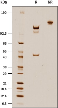 Recombinant Human Enteropeptidase/Enterokinase Protein SDS-PAGE