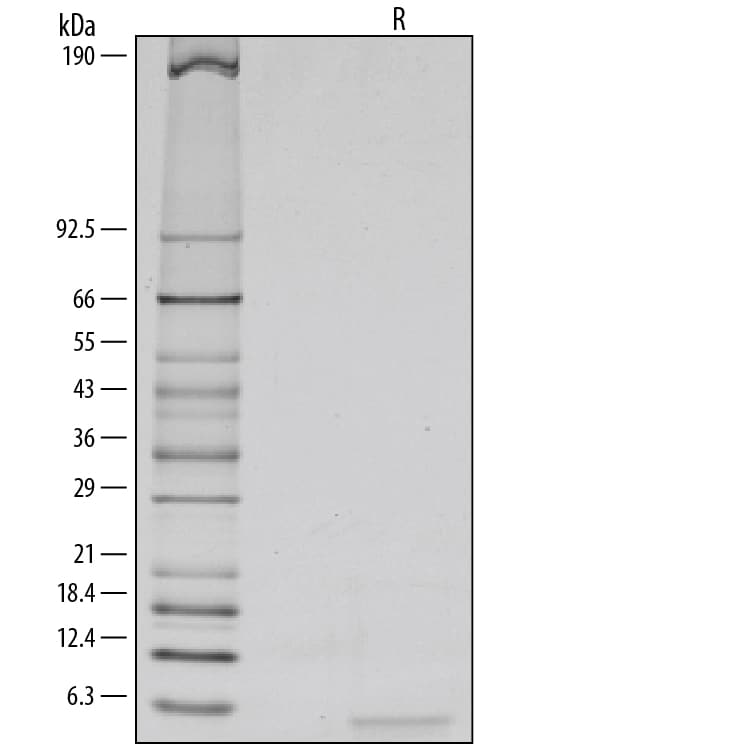 Recombinant Human Epiregulin Protein SDS-PAGE