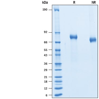 Recombinant Human ErbB3/Her3 His-tag Protein SDS-PAGE