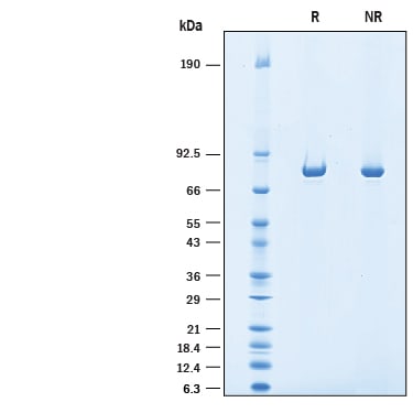 Recombinant Human F13A1 His-tag Protein SDS-PAGE