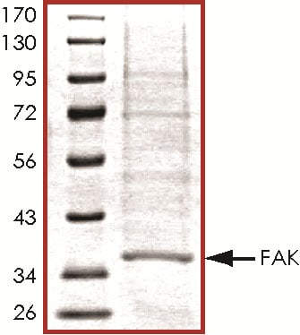 Recombinant Human Active FAK Protein SDS-PAGE