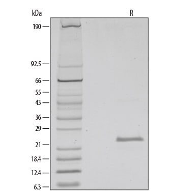 Recombinant Human FGF-21 Protein SDS-PAGE