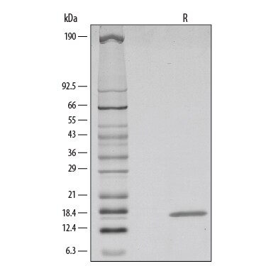 Recombinant Human FGF-4 Protein SDS-PAGE