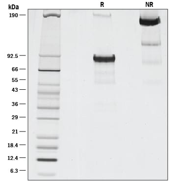 Recombinant Human FGFR1 beta (IIIc) Fc Chimera Protein SDS-PAGE