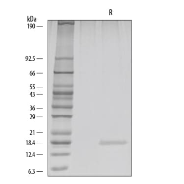 Recombinant Human FGF basic/FGF2 (146 aa) GMP Protein SDS-PAGE