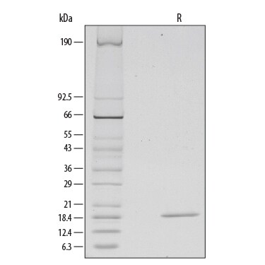 Recombinant Human FGF basic/FGF2/bFGF (157 aa) Protein SDS-PAGE
