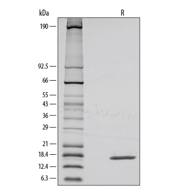 Recombinant Mouse FGF basic/FGF2/bFGF Protein SDS-PAGE