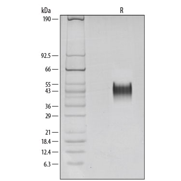 Recombinant Human Fc gamma RIIIA/CD16a Protein SDS-PAGE