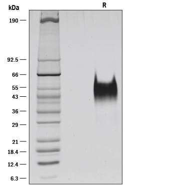 Recombinant Human Fc gamma RIIIB/CD16b Protein SDS-PAGE