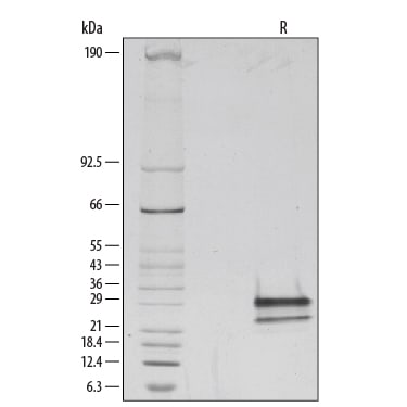 Recombinant Mouse Flt-3 Ligand/FLT3L Protein SDS-PAGE