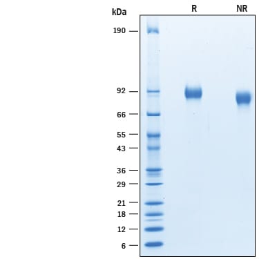 Recombinant Human Flt-3/Flk-2 His-tag Protein SDS-PAGE
