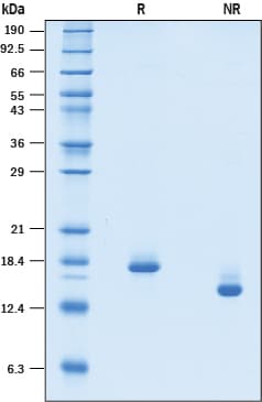 Recombinant Human Flt-3 Ligand/FLT3L GMP Protein SDS-PAGE