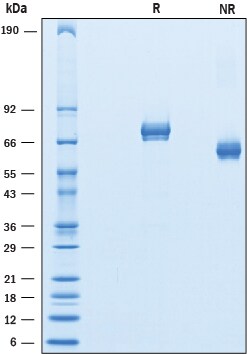 Recombinant Mouse GASP-1/WFIKKN2 Protein SDS-PAGE
