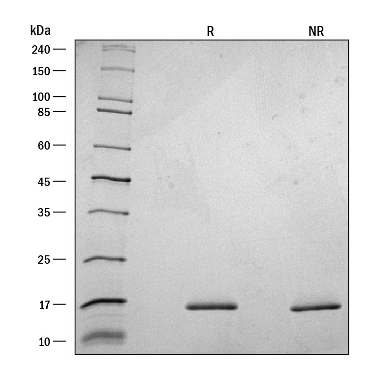 ProDots Recombinant Human G-CSF Protein SDS-PAGE