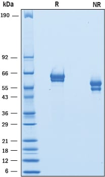 Recombinant Mouse GFR alpha-1 His-tag Protein SDS-PAGE