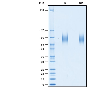 Recombinant Cynomolgus Monkey GM-CSF R alpha His Protein SDS-PAGE
